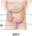 腸炎的癥狀有哪些